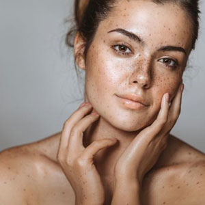 Several Misconceptions Around Pigmentation Peels