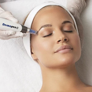 Skin Needling Facial Treatment Work